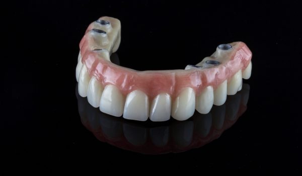realistic dental permanent upper jaw prosthesis for a 50-year-old patient on a black background